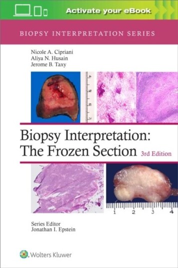 Biopsy Interpretation: The Frozen Section Av Nicole A. Md Cipriani, Aliya N. Husain, Jerome B. Taxy