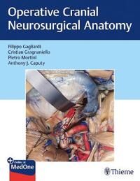 Operative Cranial Neurosurgical Anatomy Av Filippo Gagliardi, Cristian Gragnaniello, Pietro Mortini, Anthony J. Caputy