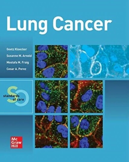 Lung Cancer: Standards Of Care Av Goetz Kloecker, Mostafa Fraig, Susanne M. Arnold, Cesar A. Perez