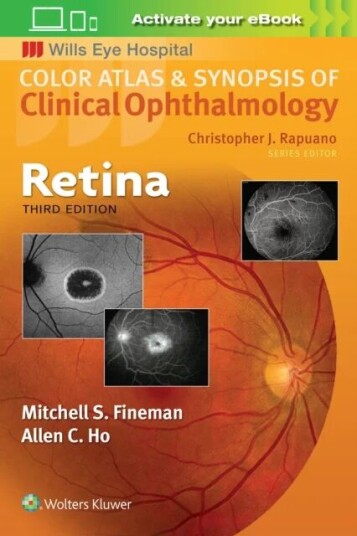 Retina Av Mitchell Fineman