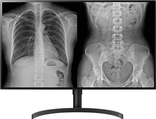 LG Diagnostisk Monitor 31.5" 8MP 32HL512D M LG Diagnostisk Monitor 31.5" 8MP 32HL512D M