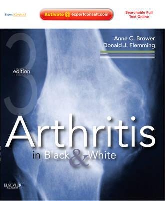 Arthritis in Black and White Expert Consult Online and Print
