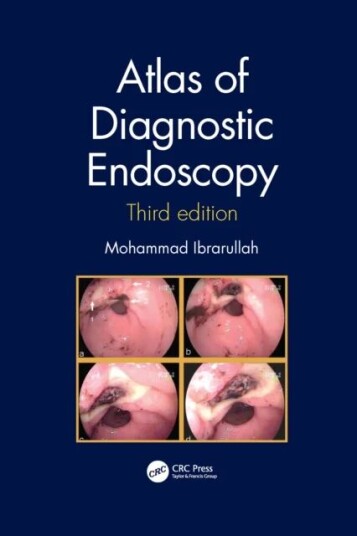 Atlas Of Diagnostic Endoscopy, 3e Av Mohammad (Apollo Hospitals India) Ibrarullah
