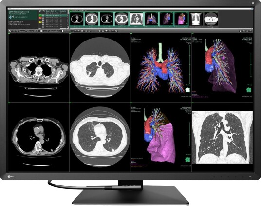 EIZO RadiForce RX1270 30.9" RX1270 EIZO RadiForce RX1270 30.9" RX1270