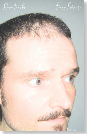 Rico Friebe Faces Meet Kassett