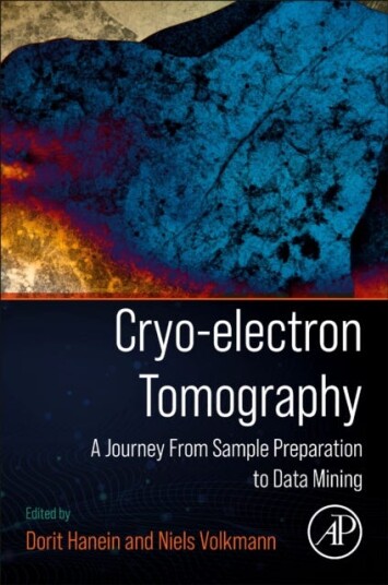Cryoelectron Tomography A Journey from Sample Preparation to Data Mining