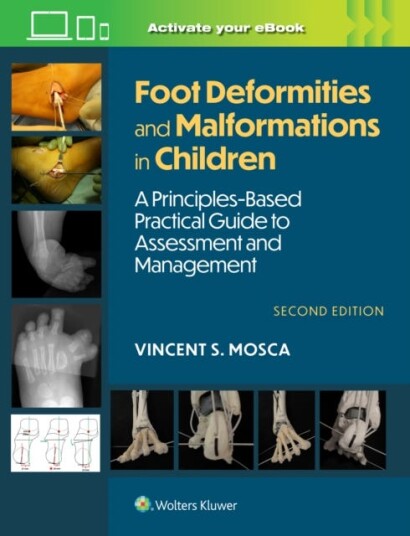 Foot Deformities and Malformations in Children A PrinciplesBased, Practical Guide to Assessment and Management: Print + eBook with Multimedia
