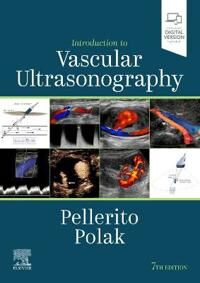 Introduction To Vascular Ultrasonography Av John S. Md Facr Fsru Faium (Associate Professor Of Radiology Hofstra North Shore-Lij School Of Medicine As