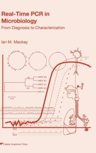 Real time PCR in Microbiology