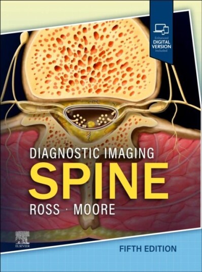 Diagnostic Imagin Spine