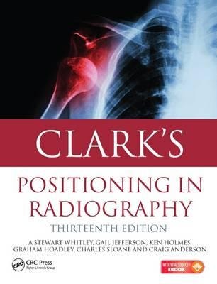 Clark'S Positioning In Radiography 13e Av A. Stewart Whitley, Gail Jefferson, Ken (University Of Cumbria Uk) Holmes, Charles (University Of Cumbr