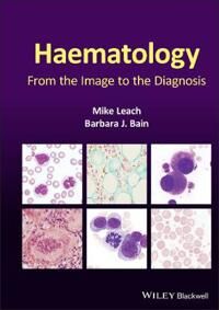 Haematology Av Mike (Gartnavel General Hospital Glasgow Uk) Leach, Barbara J. (St Mary'S Hospital London Uk) Bain