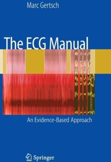 The ECG Manual