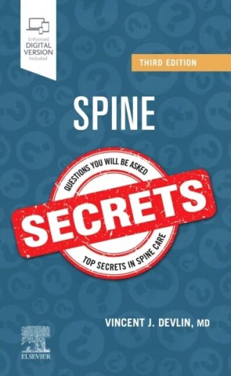 Spine Secrets Av Vincent J. (Orthopaedic Surgeon Silver Spring Maryland) Devlin