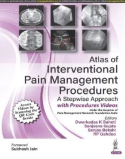 Atlas Of Interventional Pain Management Procedures Av Dwarkadas K Baheti, Sanjeeva Gupta, Sanjay Bakshi, Rp Gehdoo