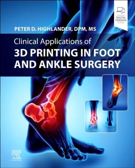 Clinical Applications Of 3d Printing In Foot And Ankle Surgery Av Peter D. Dpm Ms Highlander