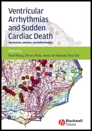 Ventricular Arrhythmias and Sudden Cardiac Death – Mechanism, Ablation and Defibrillation