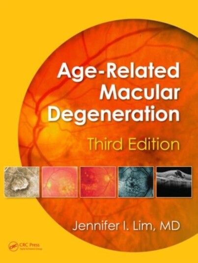 Age-Related Macular Degeneration Third Edition