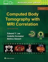 Lee Edward Y. Computed Body Tomography with MRI Correlation