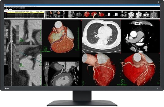 EIZO RadiForce MX317W 31" MX317W EIZO RadiForce MX317W 31" MX317W