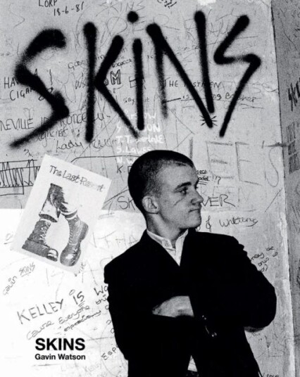 Skins Av Gavin Watson