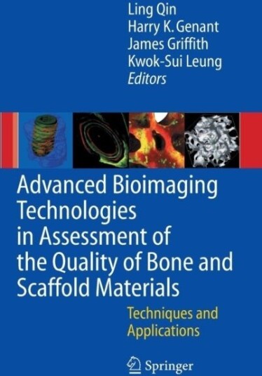 Advanced Bioimaging Technologies in Assessment of the Quality of Bone and Scaffold Materials