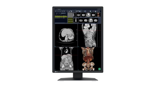 EIZO RadiForce RX270 LCD skjerm 2MP farge 21.3" EIZO RadiForce RX270 LCD skjerm 2MP farge 21.3"