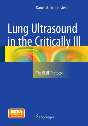 Lung Ultrasound In The Critically Ill Av Daniel A. Lichtenstein