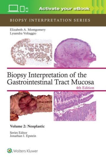 Biopsy Interpretation of the Gastrointestinal Tract Mucosa Volume 2 Neoplastic: Print + eBook with Multimedia