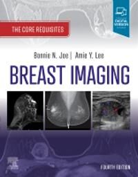 Breast Imaging Av Bonnie N. (Professor Radiology<br>chief Breast Imaging<br>department Of Radiology And Biomedical Imaging<br>univer
