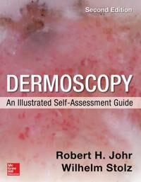 Dermoscopy: An Illustrated Self-Assessment Guide, 2/e Av Robert Johr, Wilhelm Stolz