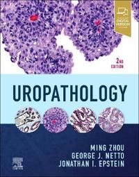 Uropathology Av Ming Md Phd (Dr. Charles T. Ashworth Professor Of Pathology Director Of Anatomic Pathology Ut Southwestern Medical Center Dallax Texas