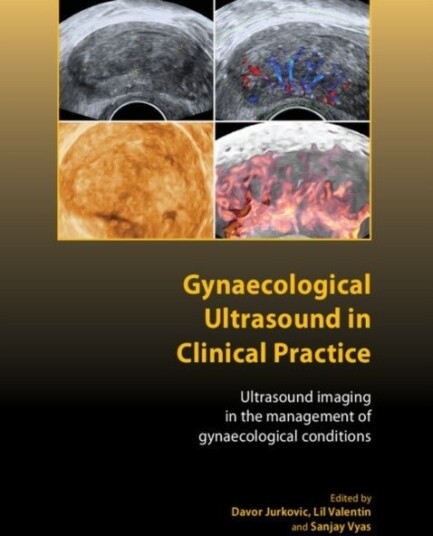 Gynaecological Ultrasound in Clinical Practice
