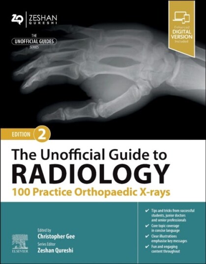 The Unofficial Guide To Radiology: 100 Practice Orthopaedic X-Rays