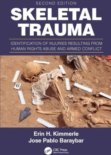 Skeletal Trauma