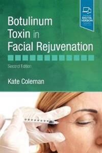 Botulinum Toxin In Facial Rejuvenation Av Kate (Consultant Oculoplastic Surgeon Blackrock Clinic Dublin Ireland) Coleman