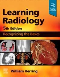 Learning Radiology Av William (Vice Chairman And Residency Program Director Albert Einstein Medical Center Philadelphia Pa) Herring