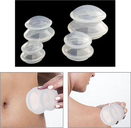 Otego Cupping for helkroppsmassasje  4-pakning XS-L