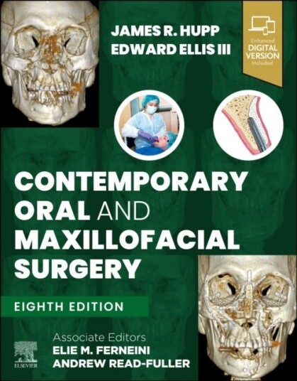 Contemporary Oral and Maxillofacial Surgery