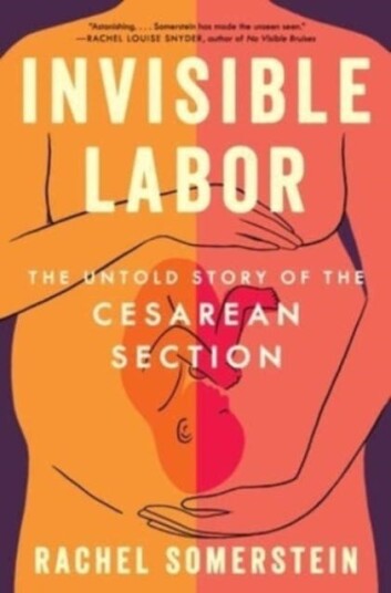 Invisible Labor The Untold Story of the Cesarean Section Invisible Labor The Untold Story of the Cesarean Section
