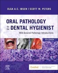 Oral Pathology For The Dental Hygienist Av Olga A. C. (Adjunct Professor<br>department Of Oral And Maxillofacial Pathology Radiology And Medicin Oral Pathology For The Dental Hygienist Av Olga A. C. (Adjunct Professor<br>department Of Oral And Maxillofacial Pathology Radiology And Medicin