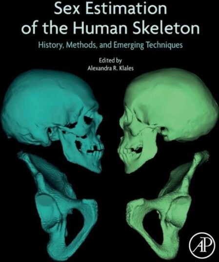 Sex Estimation of the Human Skeleton