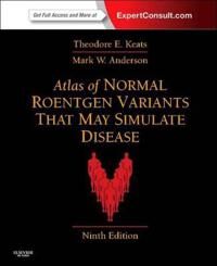 Atlas Of Normal Roentgen Variants That May Simulate Disease Av Theodore E. (Alumni Professor Of Radiology Department Of Radiology University Of Virgin