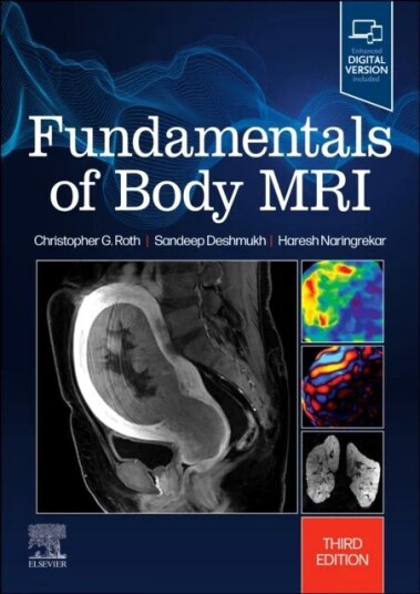 Fundamentals Of Body Mri Av Christopher G. (Associate Professor Vice Chair Quality And Performance Vice Chair Methodist Hospital Division Department O Fundamentals Of Body Mri Av Christopher G. (Associate Professor Vice Chair Quality And Performance Vice Chair Methodist Hospital Division Department O