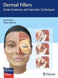 Dermal Fillers Av Andre Vieira Braz, Thais Harumi Sakuma