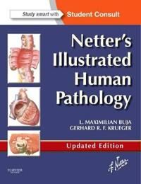 Netter'S Illustrated Human Pathology Updated Edition Av L. Maximilian M.D. (Professor Of Pathology And Laboratory Medicine At The University Of T Netter'S Illustrated Human Pathology Updated Edition Av L. Maximilian M.D. (Professor Of Pathology And Laboratory Medicine At The University Of T