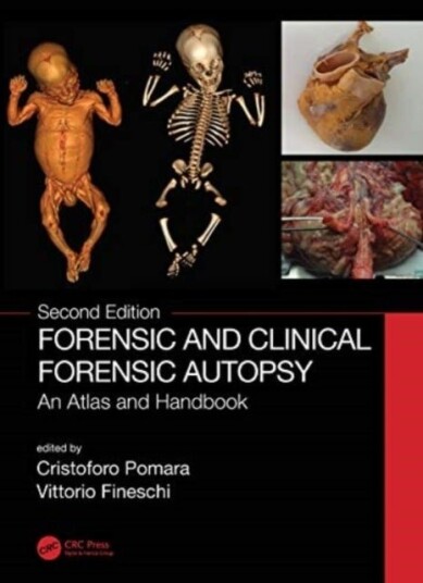 Forensic and Clinical Forensic Autopsy Forensic and Clinical Forensic Autopsy