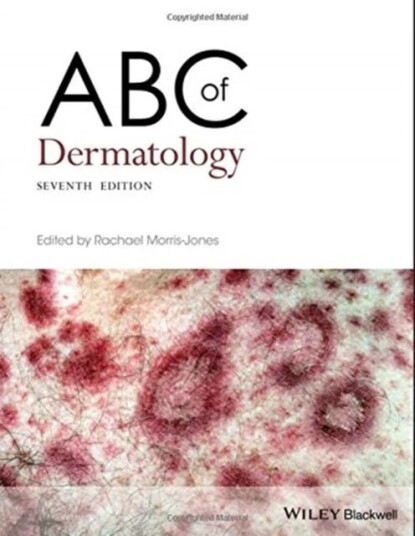 Abc Of Dermatology