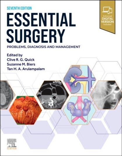 Essential Surgery : Problems Diagnosis and Manage
