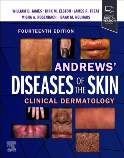 Andrews' Diseases of the Skin  Clinical Dermatology